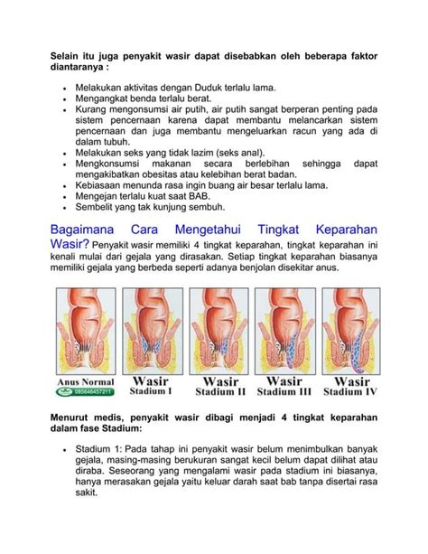 wasir
